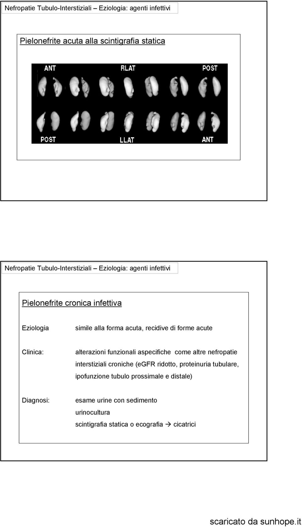 forme acute Clinica: alterazioni funzionali aspecifiche come altre nefropatie interstiziali croniche (egfr ridotto, proteinuria