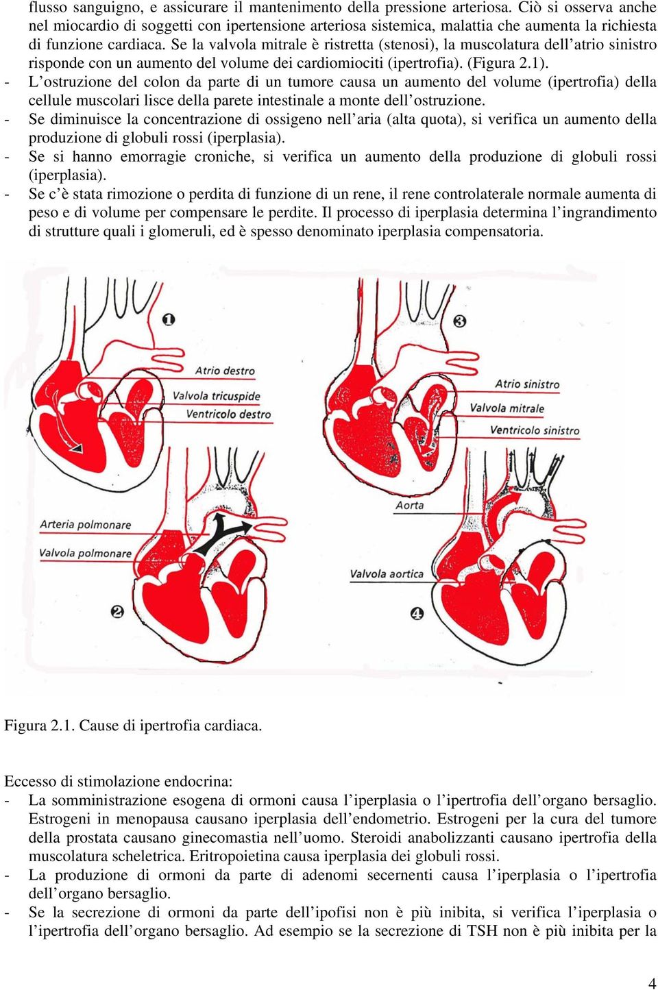 Se la valvola mitrale è ristretta (stenosi), la muscolatura dell atrio sinistro risponde con un aumento del volume dei cardiomiociti (ipertrofia). (Figura 2.1).