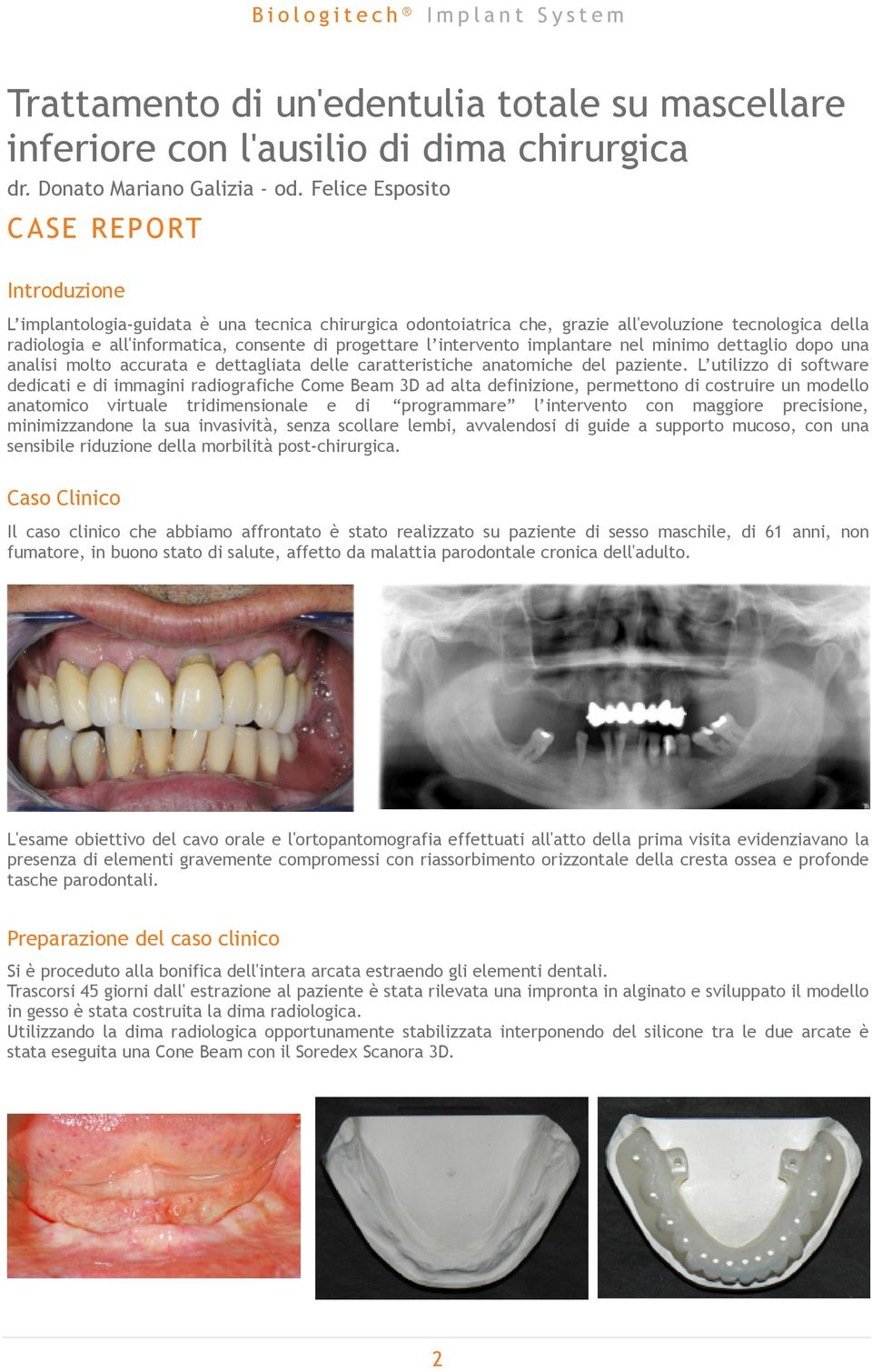 progettare l intervento implantare nel minimo dettaglio dopo una analisi molto accurata e dettagliata delle caratteristiche anatomiche del paziente.