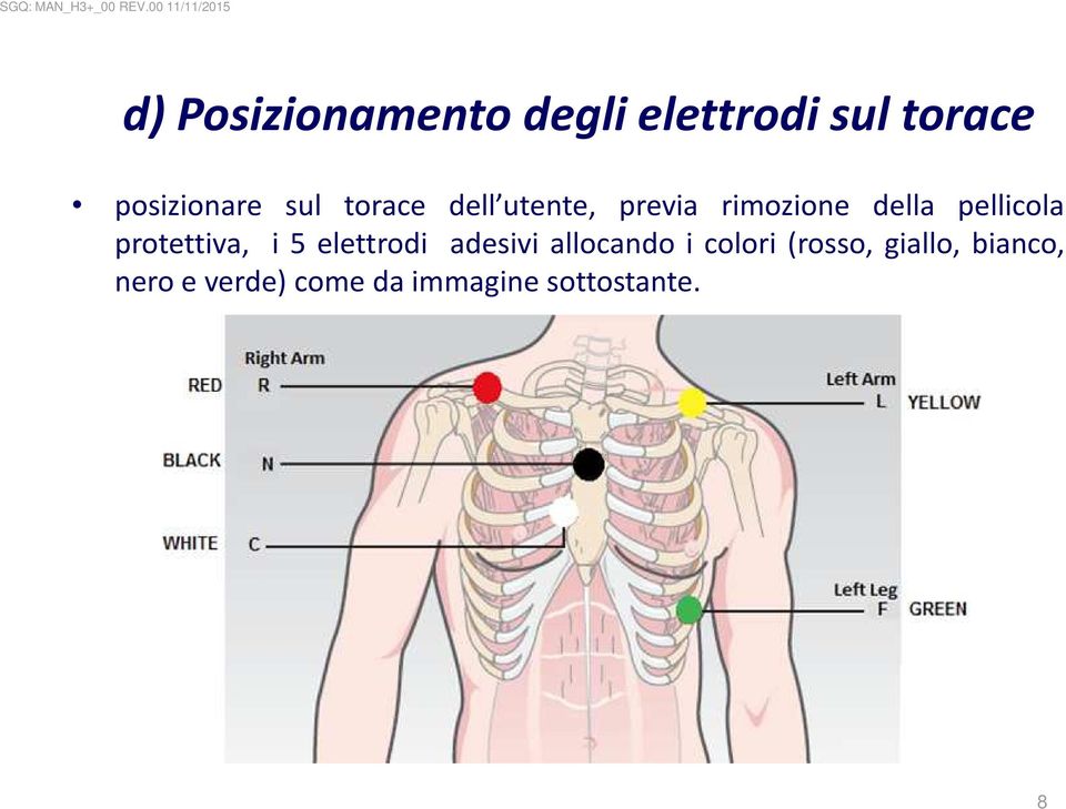 protettiva, i 5 elettrodi adesivi allocando i colori