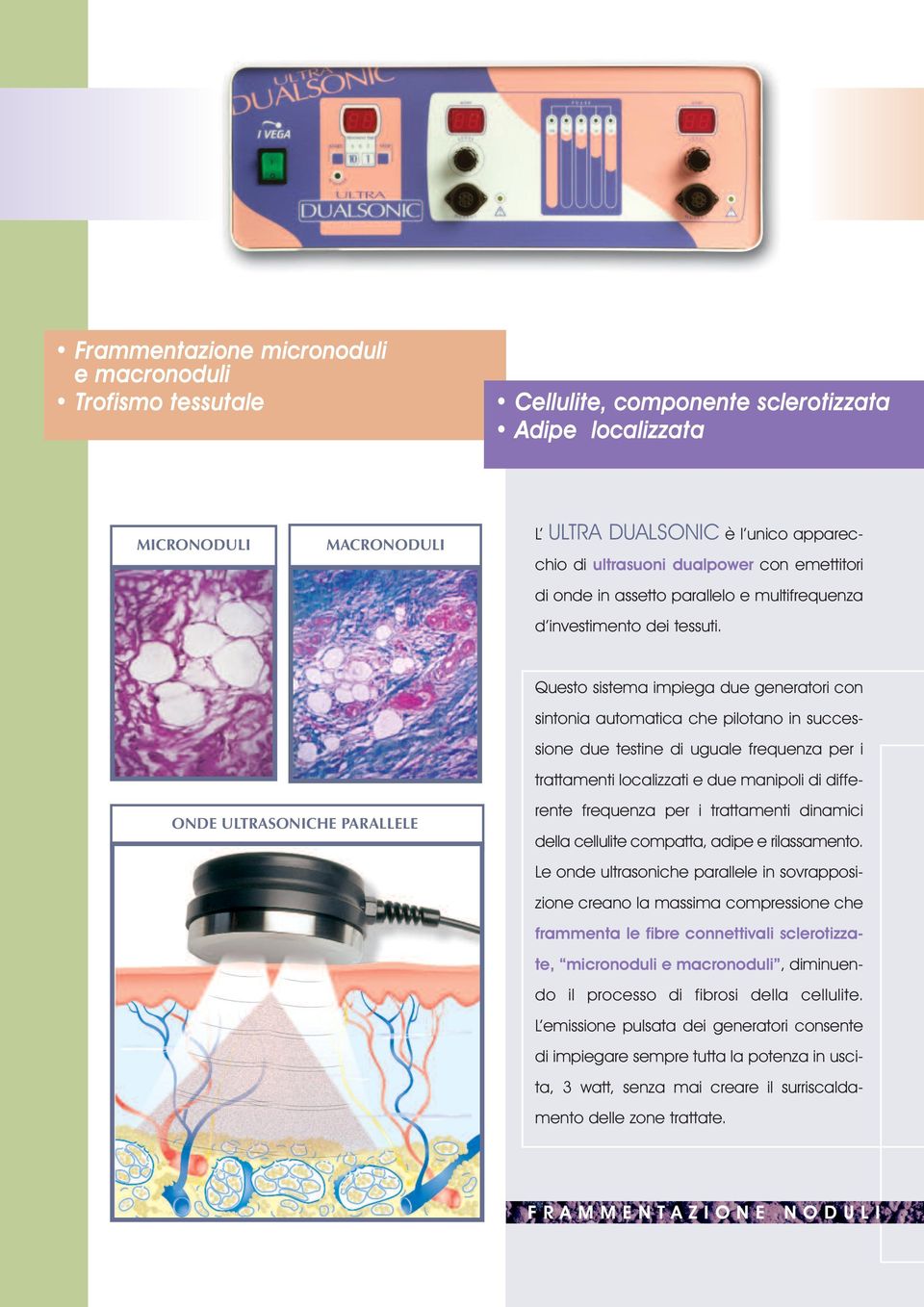 ONDE ULTRASONICHE PARALLELE Questo sistema impiega due generatori con sintonia automatica che pilotano in successione due testine di uguale frequenza per i trattamenti localizzati e due manipoli di