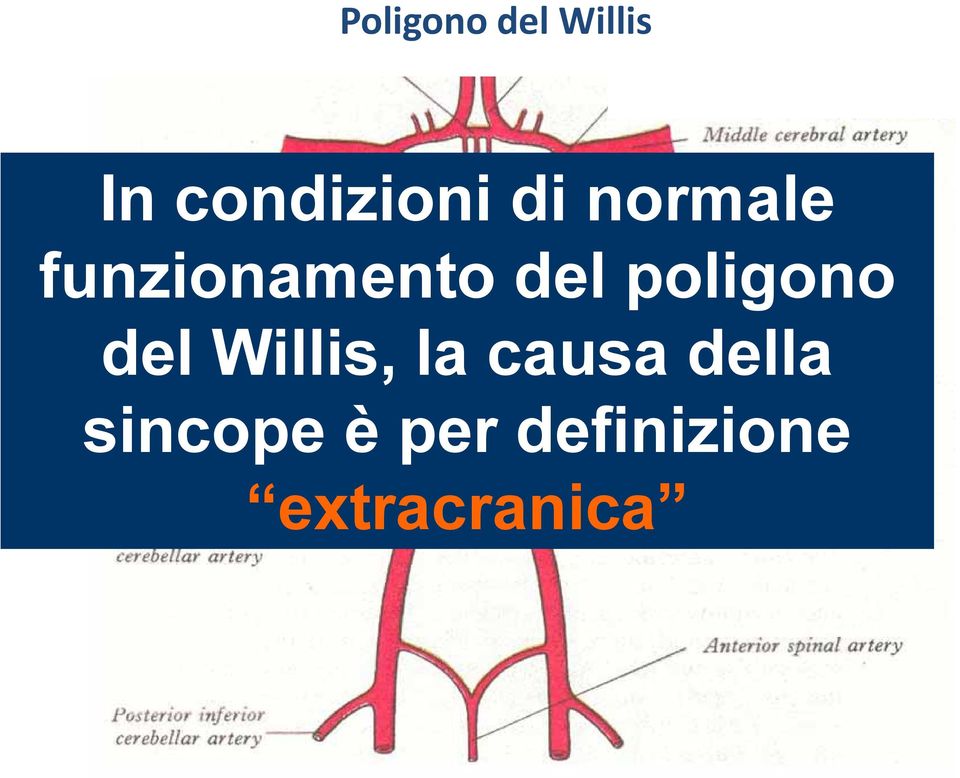 sincope è del Willis, la causa della una ipoperfusione