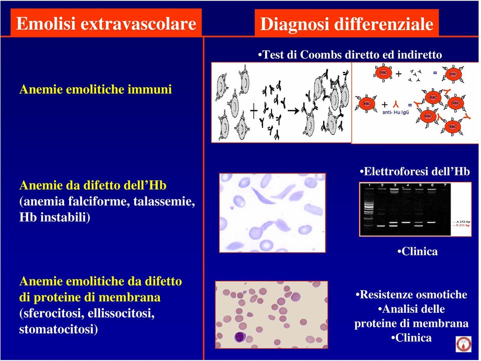 Elettroforesi dell Hb Clinica Anemie emolitiche da difetto di proteine di membrana