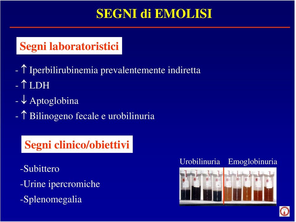 fecale e urobilinuria Segni clinico/obiettivi -Subittero