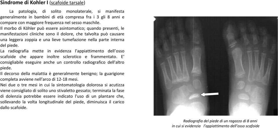 Il morbo di Köhler può essere asintomatico; quando presenti, le manifestazioni cliniche sono il dolore, che talvolta può causare una leggera zoppia e una lieve tumefazione nella parte interna del