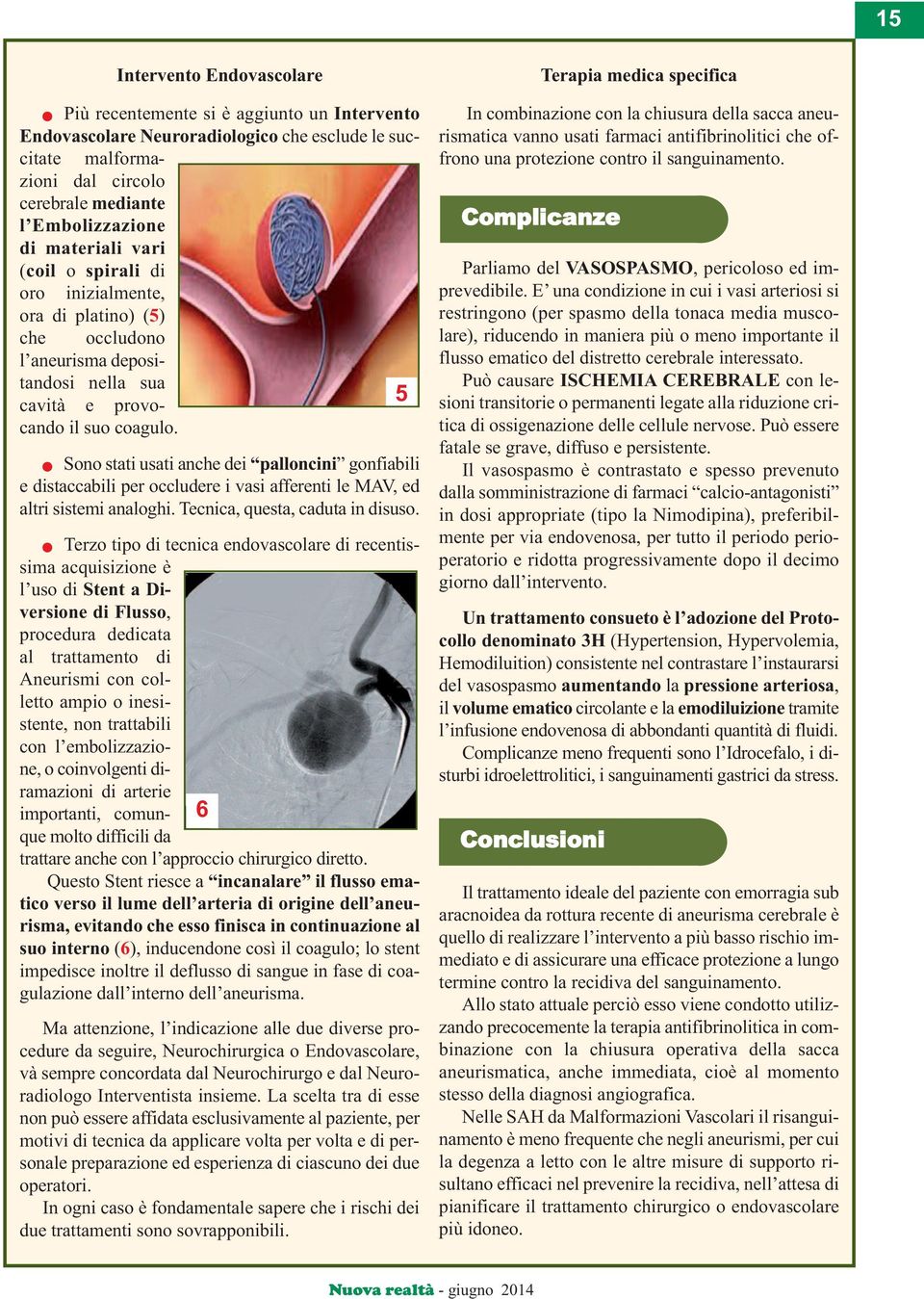 n Sono stati sati anche dei palloncini gonfiabili e distaccabili per occldere i vasi afferenti le MAV, ed altri sistemi analoghi. Tecnica, qesta, cadta in disso.