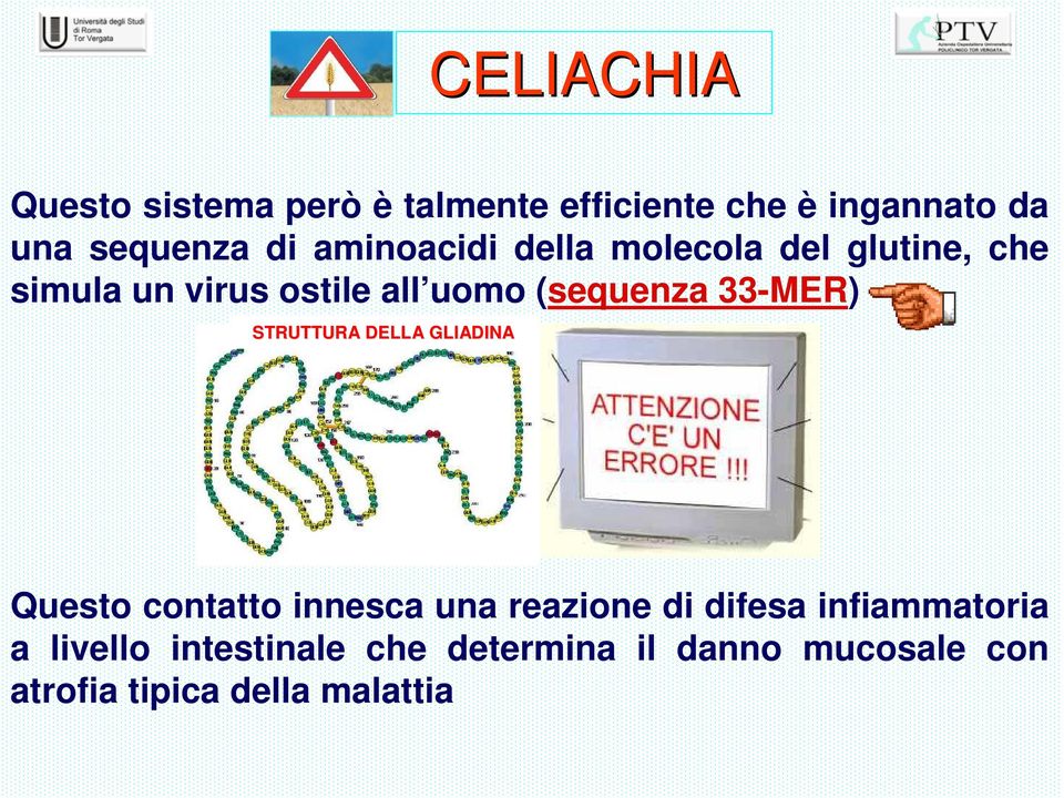 33-MER) STRUTTURA DELLA GLIADINA Questo contatto innesca una reazione di difesa