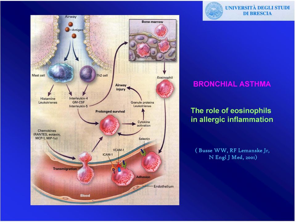 inflammation ( Busse WW, RF