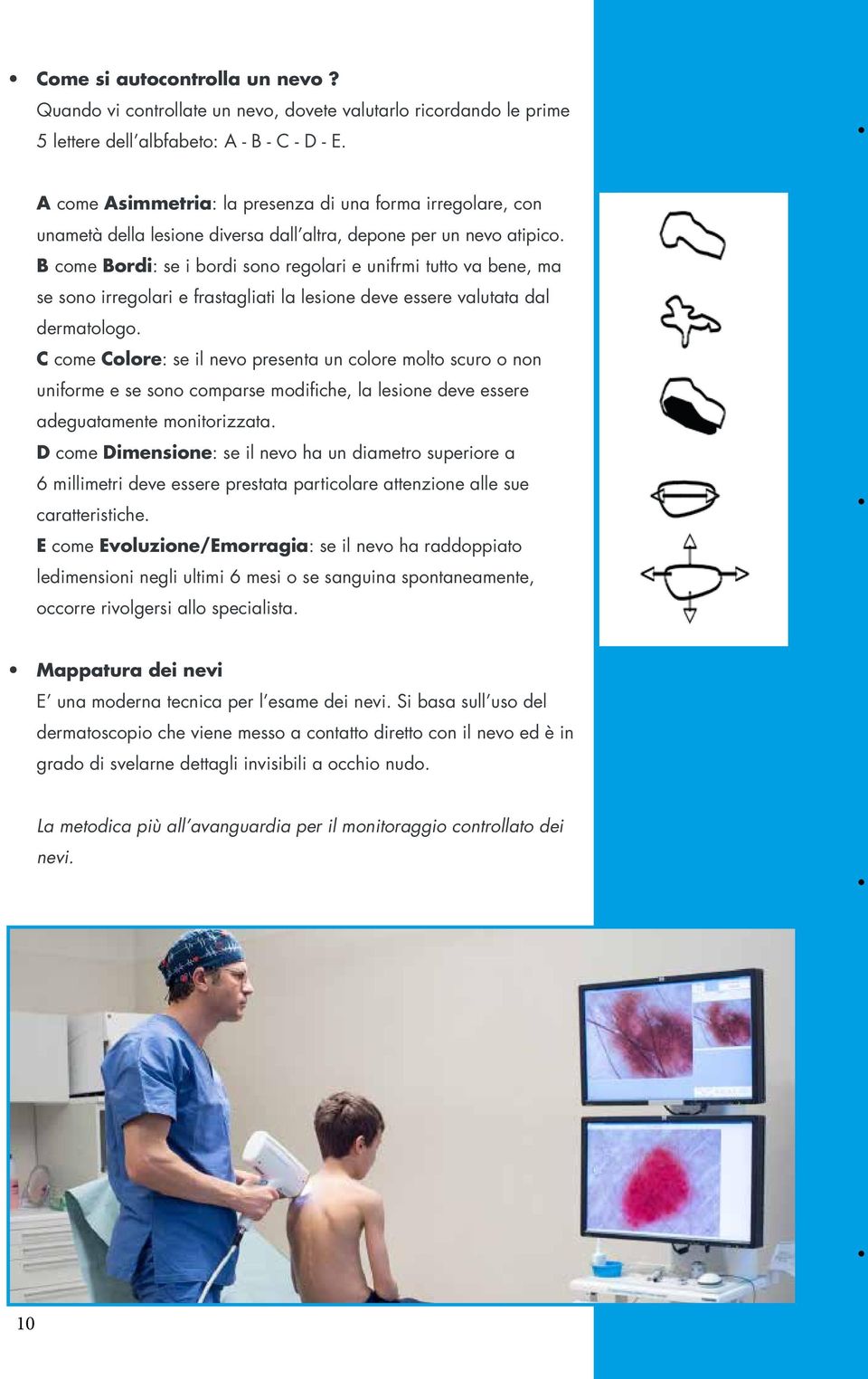 B come Bordi: se i bordi sono regolari e unifrmi tutto va bene, ma se sono irregolari e frastagliati la lesione deve essere valutata dal dermatologo.