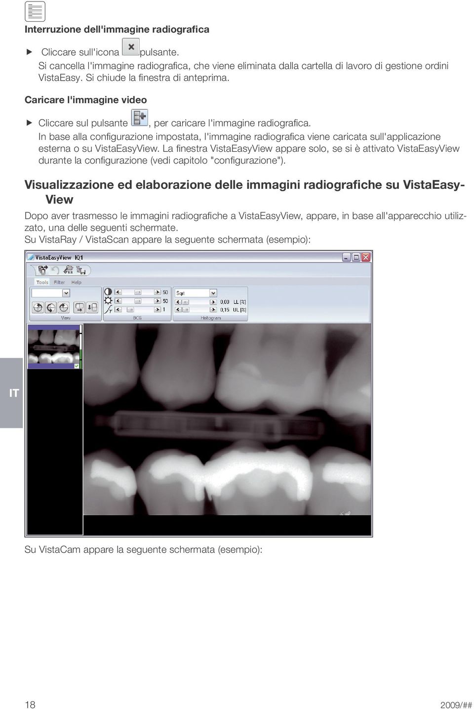 In base alla configurazione impostata, l'immagine radiografica viene caricata sull'applicazione esterna o su VistaEasyView.