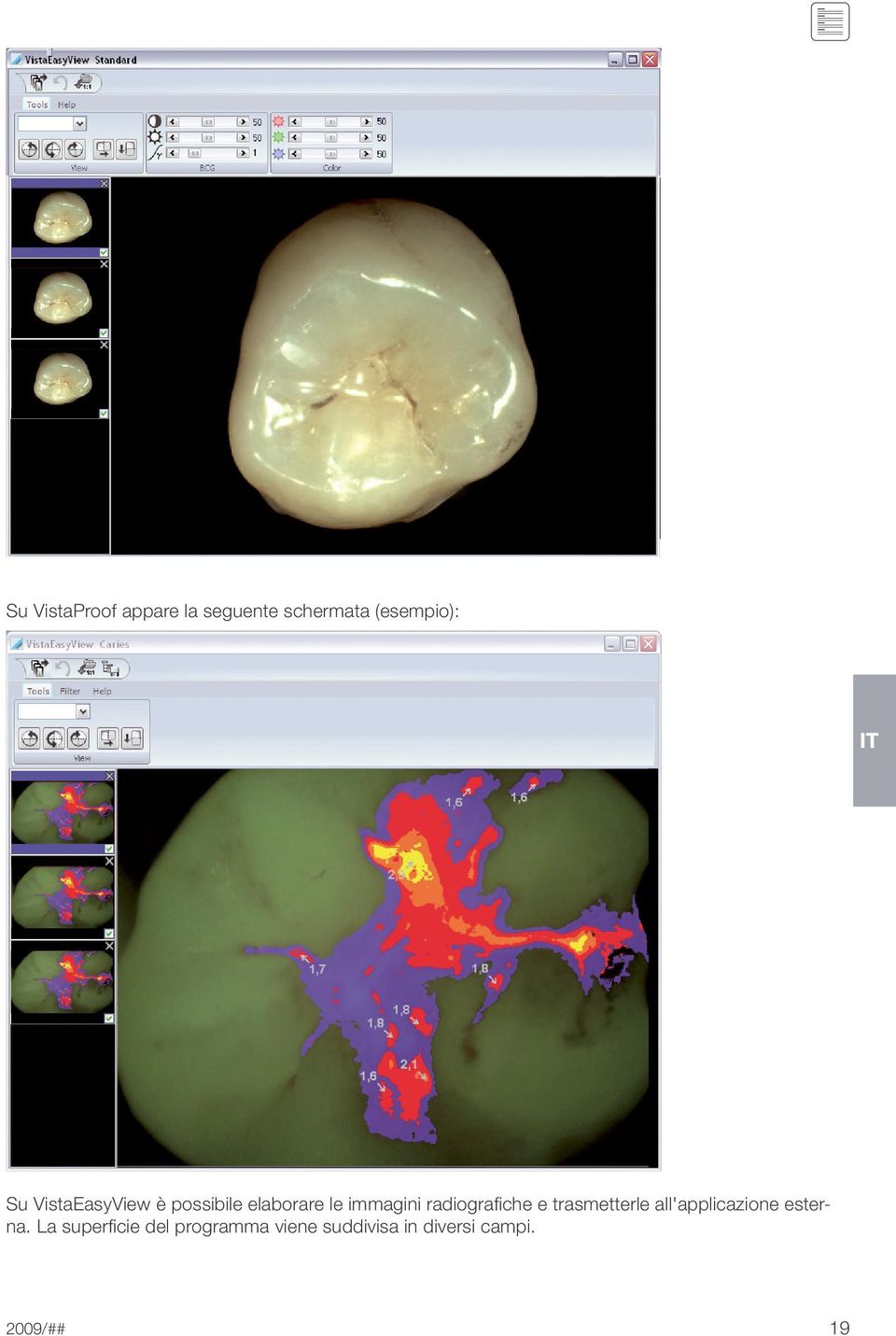 radiografiche e trasmetterle all'applicazione esterna.