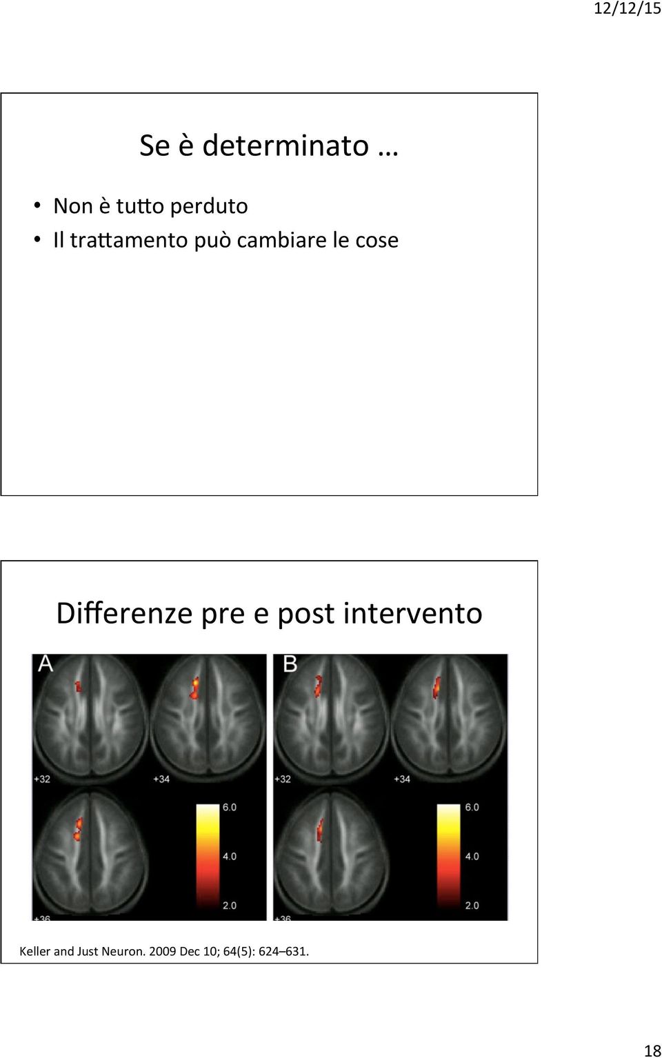 Differenze pre e post intervento Keller