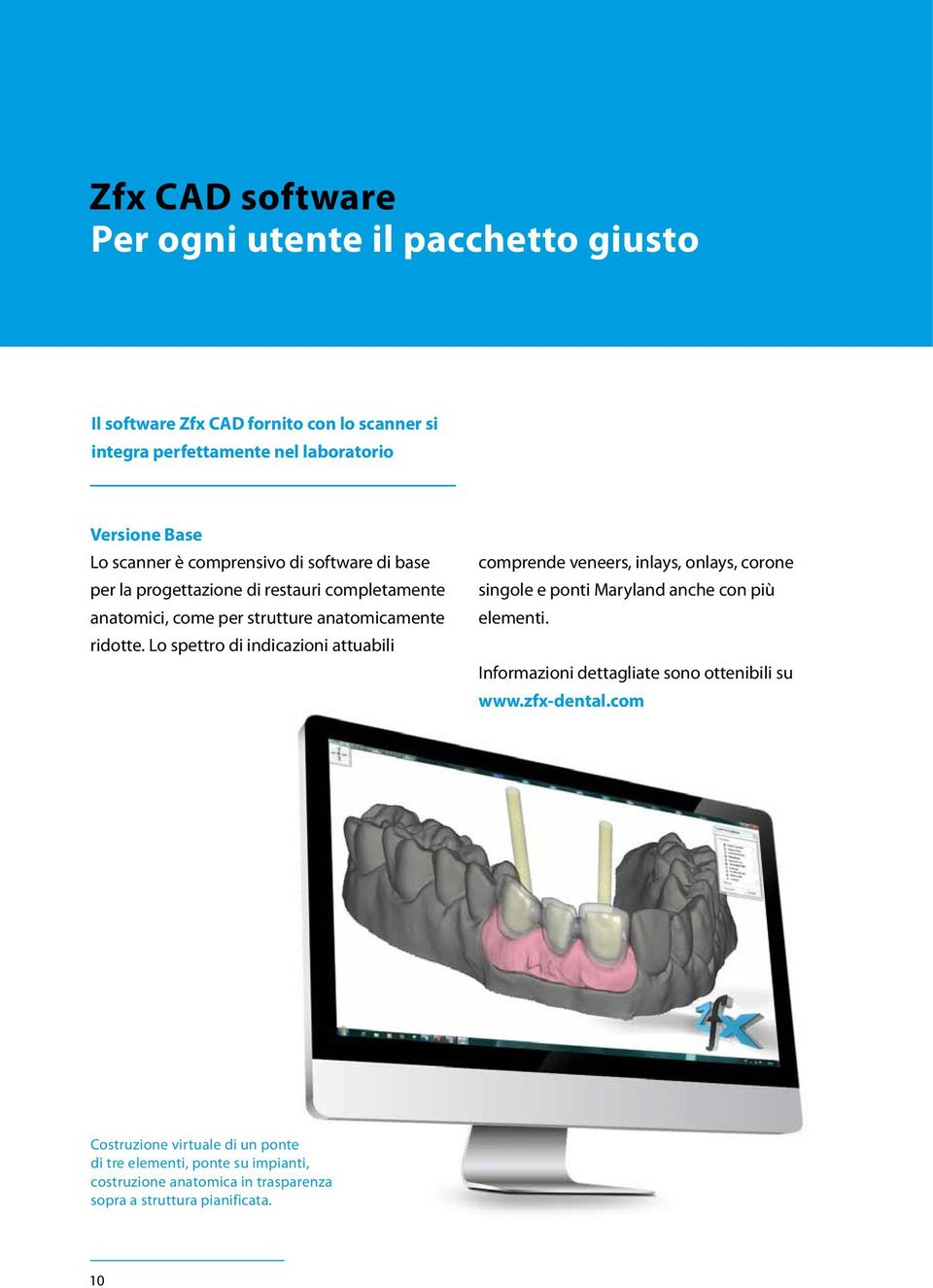 Lo spettro di indicazioni attuabili comprende veneers, inlays, onlays, corone singole e ponti Maryland anche con più elementi.