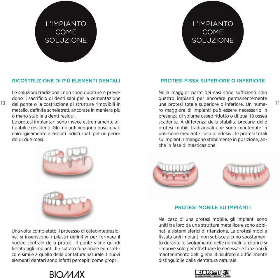 totale superiore o inferiore. Un numero 11 metallo, definite scheletrati, ancorate in maniera più maggiore di impianti può essere necessario in o meno stabile a denti residui.