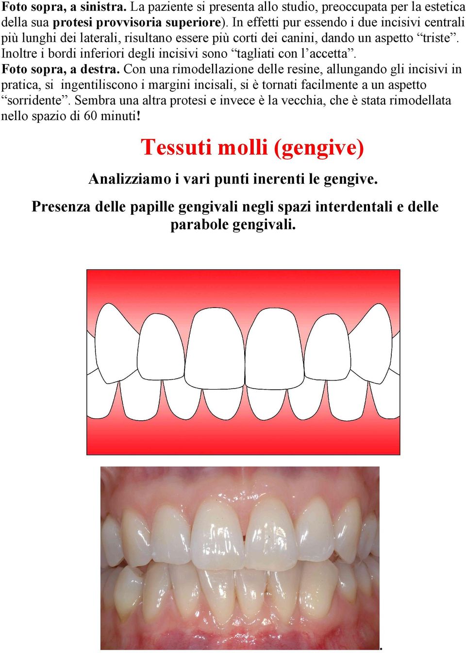 Inoltre i bordi inferiori degli incisivi sono tagliati con l accetta. Foto sopra, a destra.