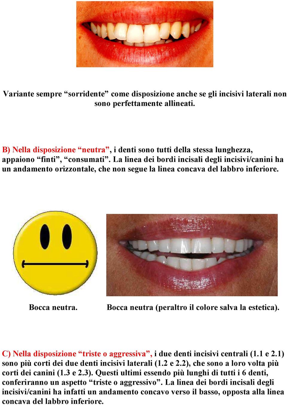 La linea dei bordi incisali degli incisivi/canini ha un andamento orizzontale, che non segue la linea concava del labbro inferiore. Bocca neutra. Bocca neutra (peraltro il colore salva la estetica).