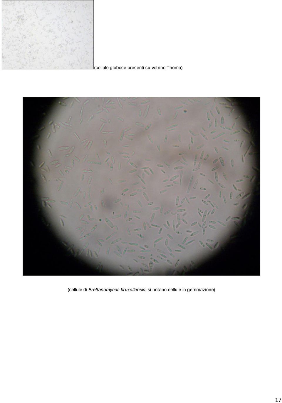 Brettanomyces bruxellensis;