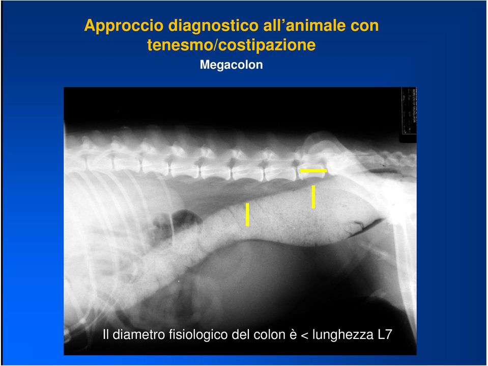 tenesmo/costipazione