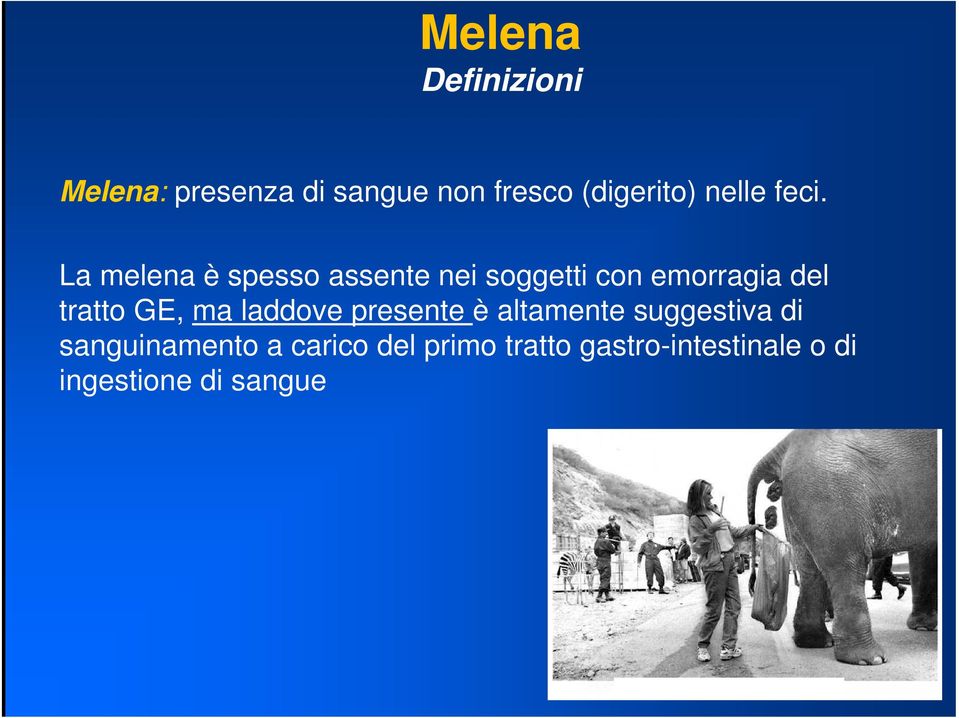 La melena è spesso assente nei soggetti con emorragia del tratto GE,