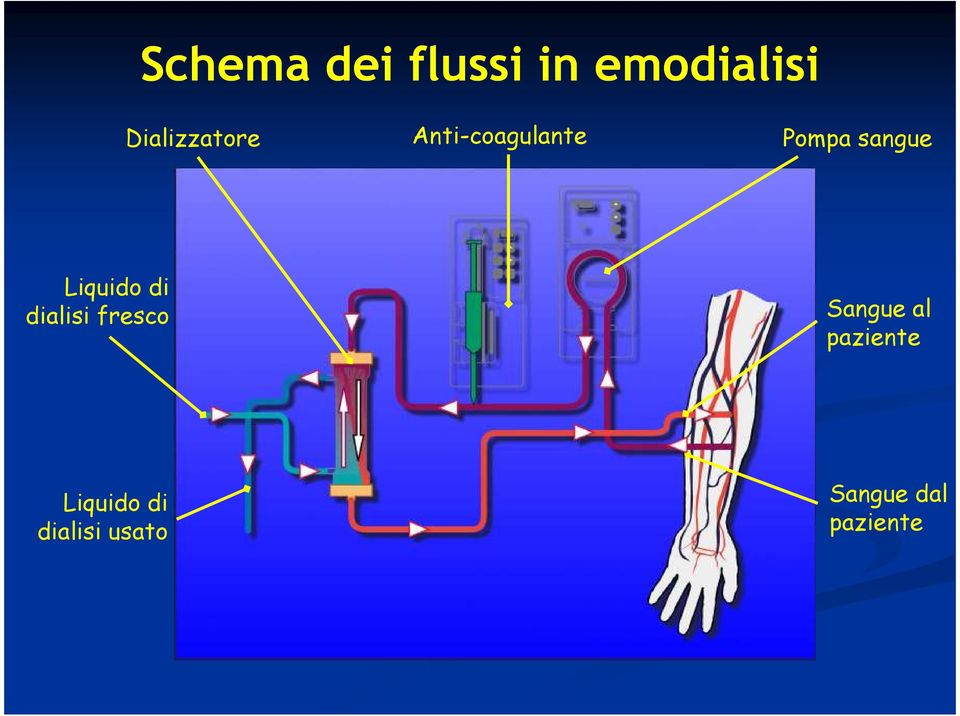 sangue Liquido di dialisi fresco Sangue