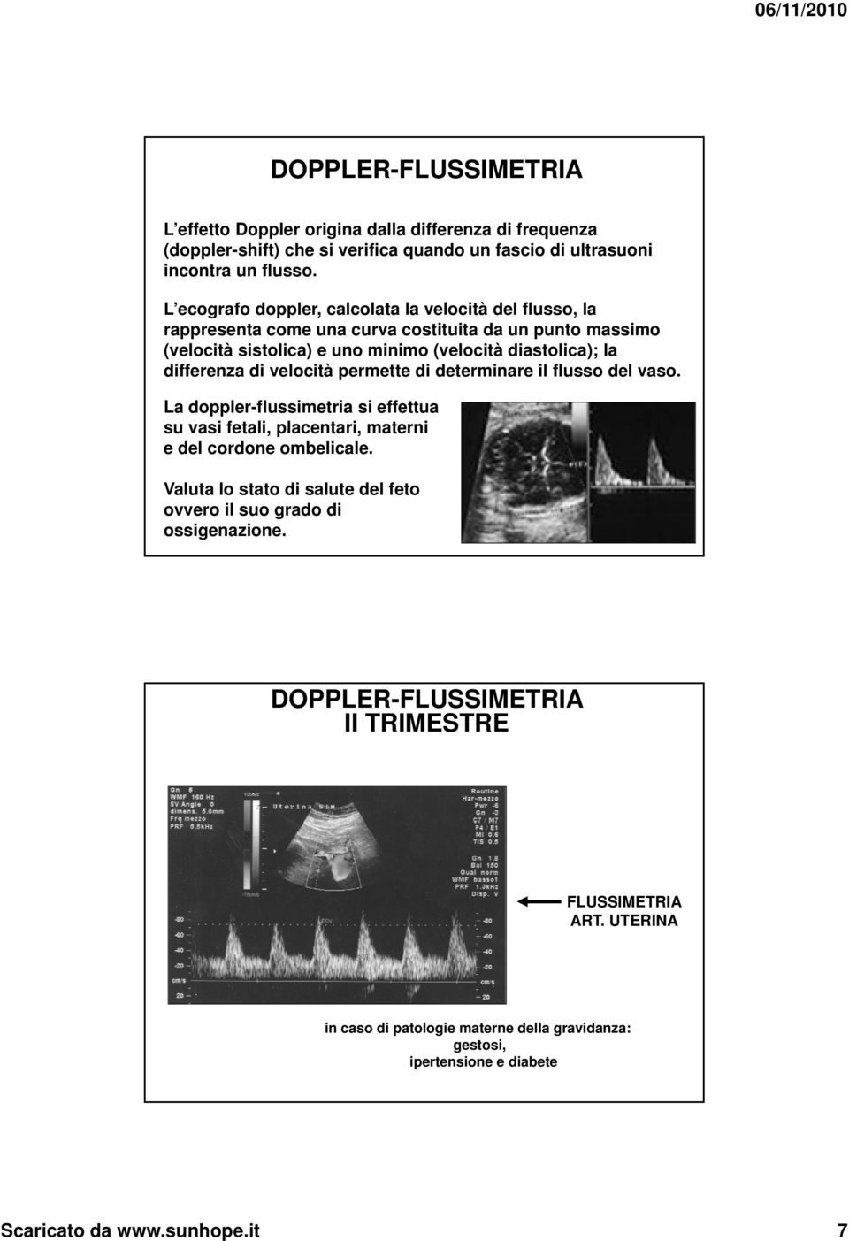 di velocità permette di determinare il flusso del vaso. La doppler-flussimetria si effettua su vasi fetali, placentari, materni e del cordone ombelicale.