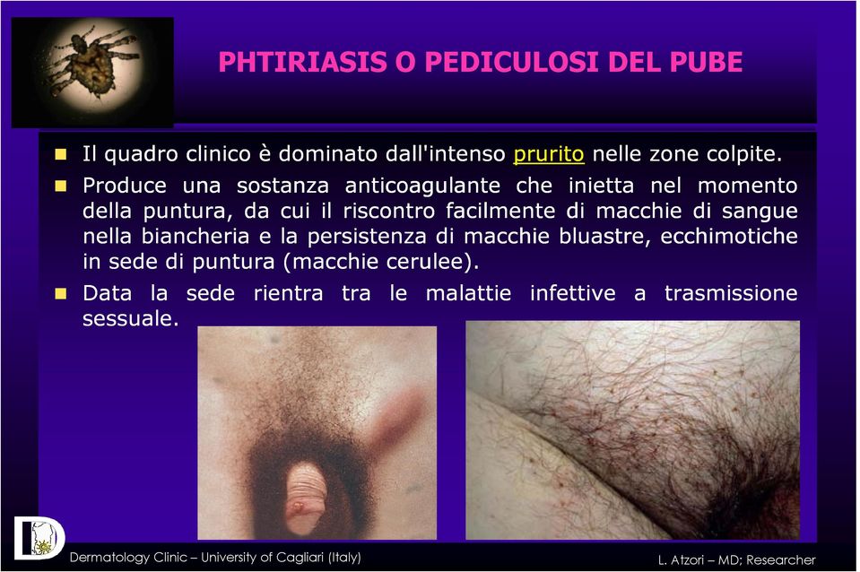 facilmente di macchie di sangue nella biancheria e la persistenza di macchie bluastre, ecchimotiche