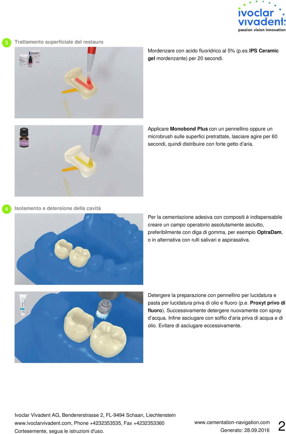 4 Isolamento e detersione della cavità Per la cementazione adesiva con compositi è indispensabile creare un campo operatorio assolutamente asciutto, preferibilmente con diga di gomma, per esempio