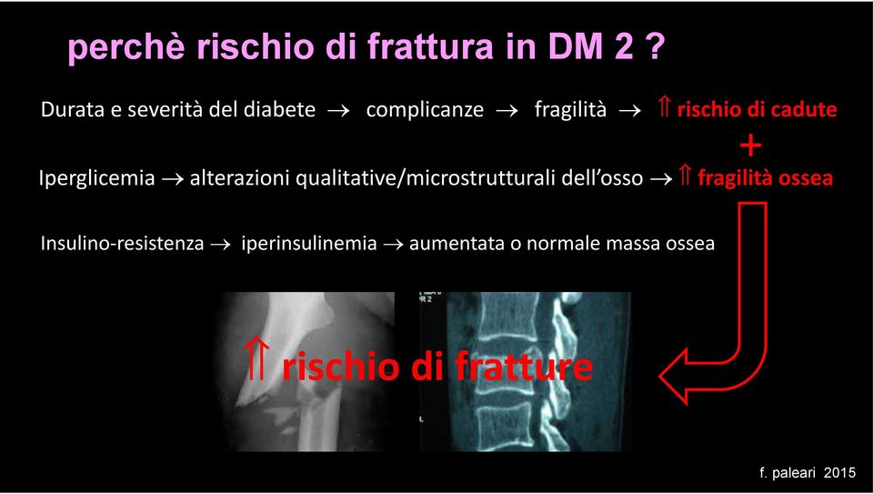 cadute Iperglicemia alterazioni qualitative/microstrutturali dell