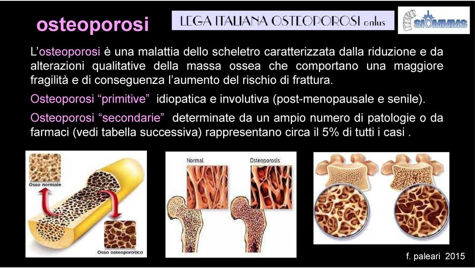 frattura. Osteoporosi primitive idiopatica e involutiva (post-menopausale e senile).