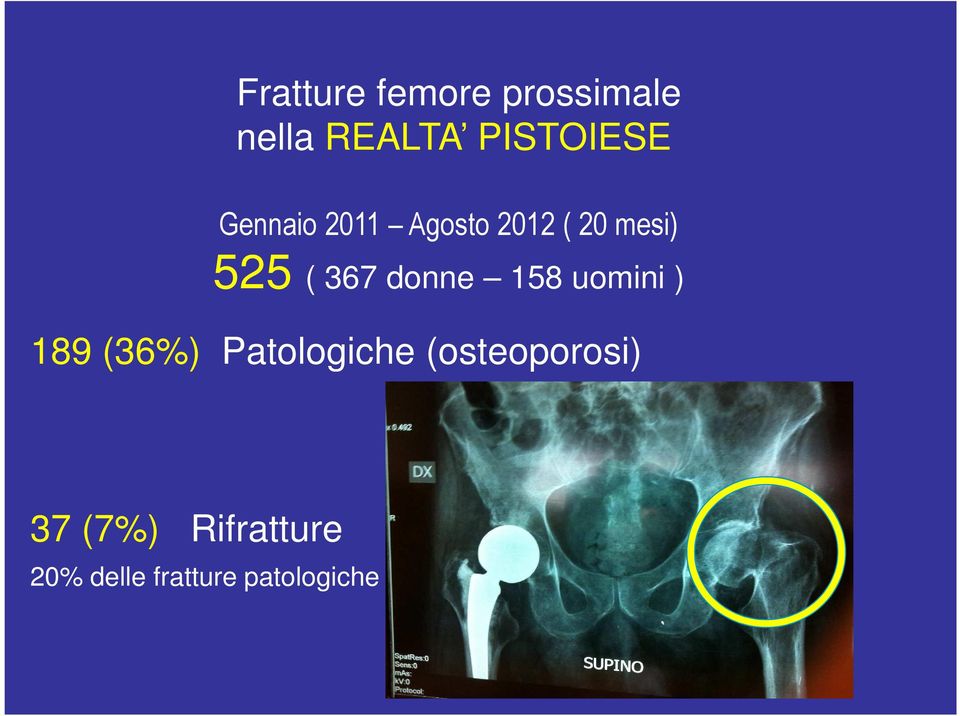 donne 158 uomini ) 189 (36%) Patologiche