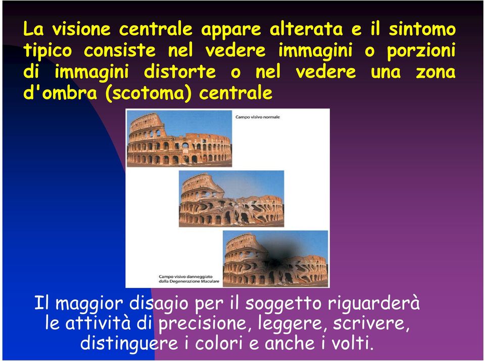 d'ombra (scotoma) centrale Il maggior disagio per il soggetto riguarderà