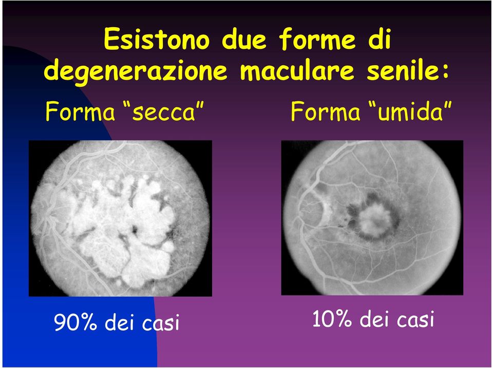 senile: Forma secca Forma