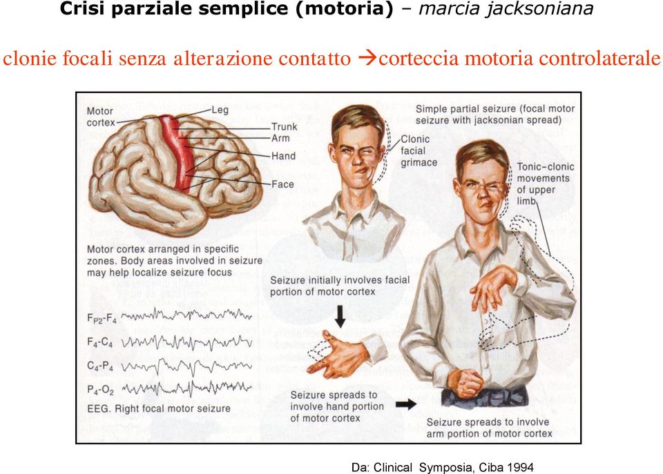 alterazione contatto corteccia motoria