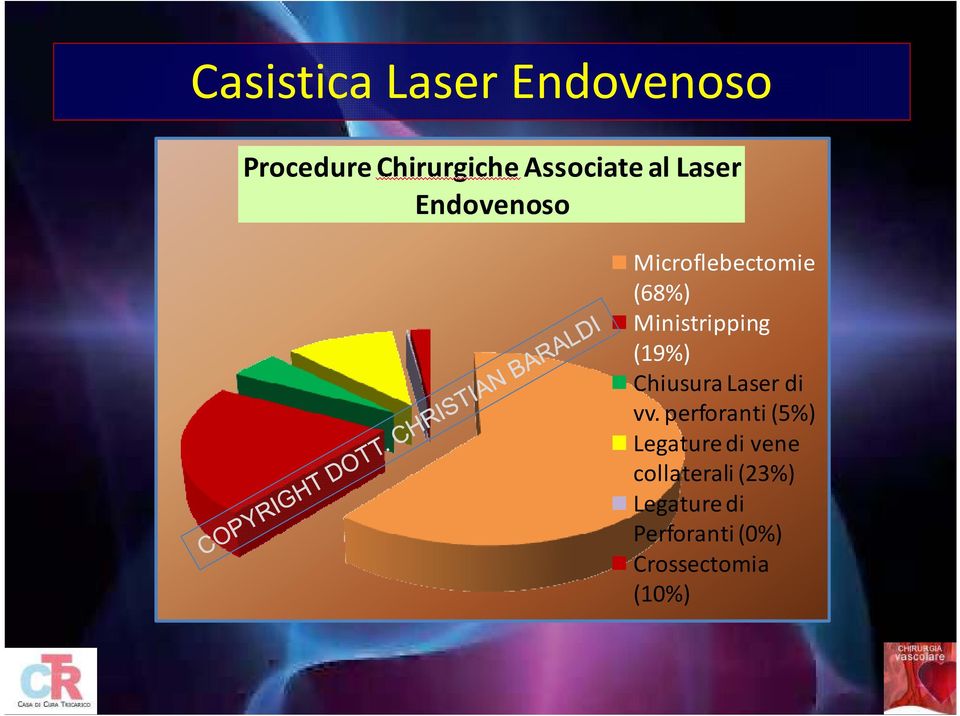 (19%) Chiusura Laser di vv.