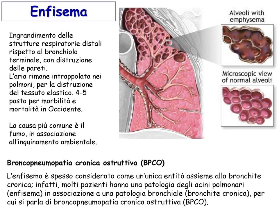 La causa più comune è il fumo, in associazione all inquinamento ambientale.