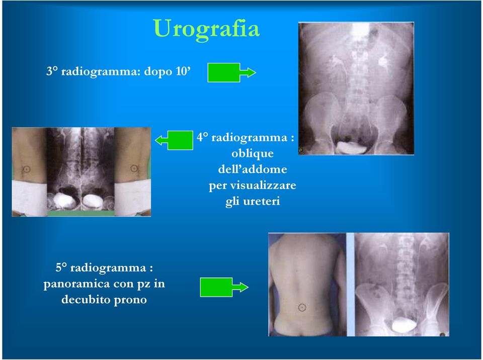 visualizzare gli ureteri 5