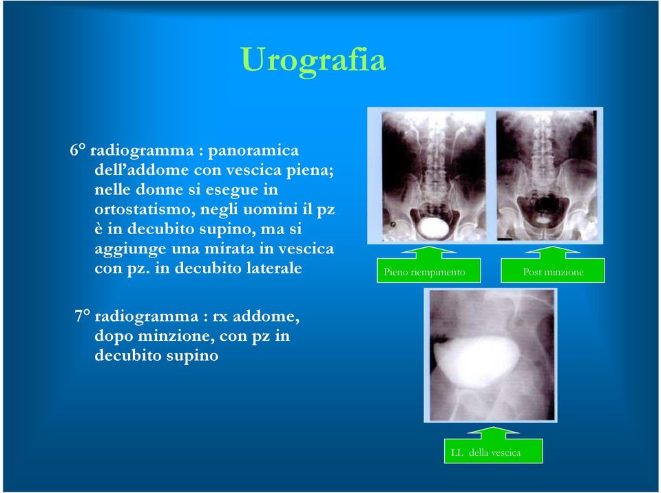 una mirata in vescica con pz.