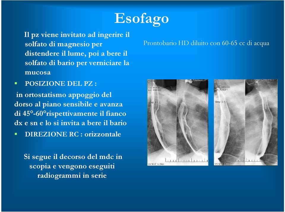 avanza di 45-60 rispettivamente il fianco dx e sne lo si invita a bere il bario DIREZIONE RC : orizzontale