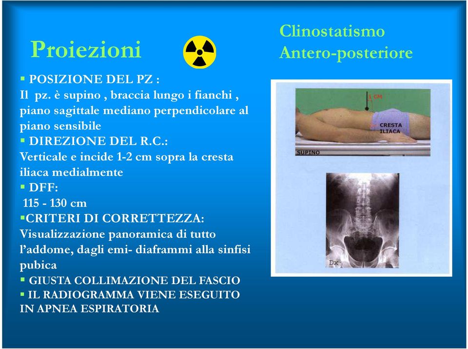 : Verticale e incide 1-2 cm sopra la cresta iliaca medialmente DFF: 115-130 cm CRITERI DI CORRETTEZZA: