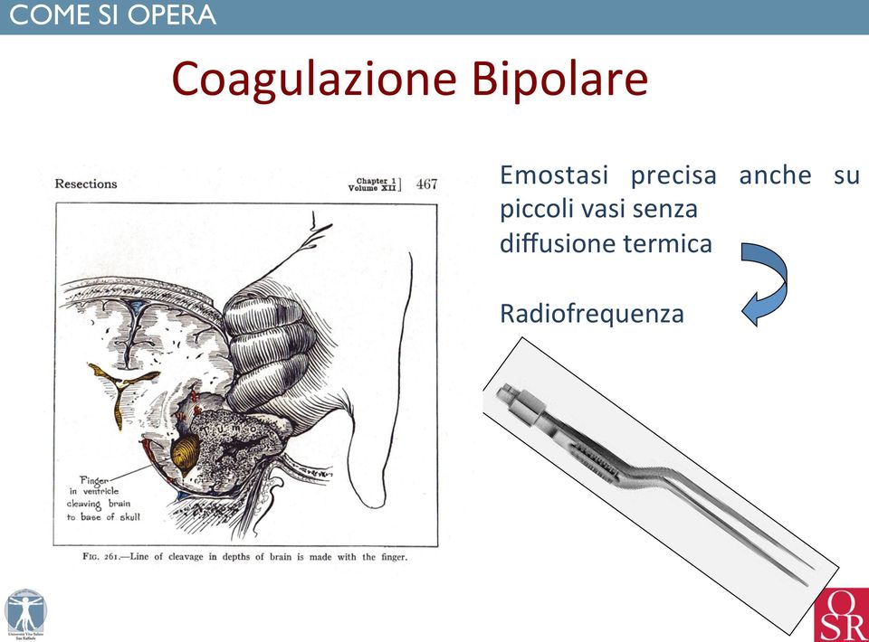 anche su piccoli vasi senza