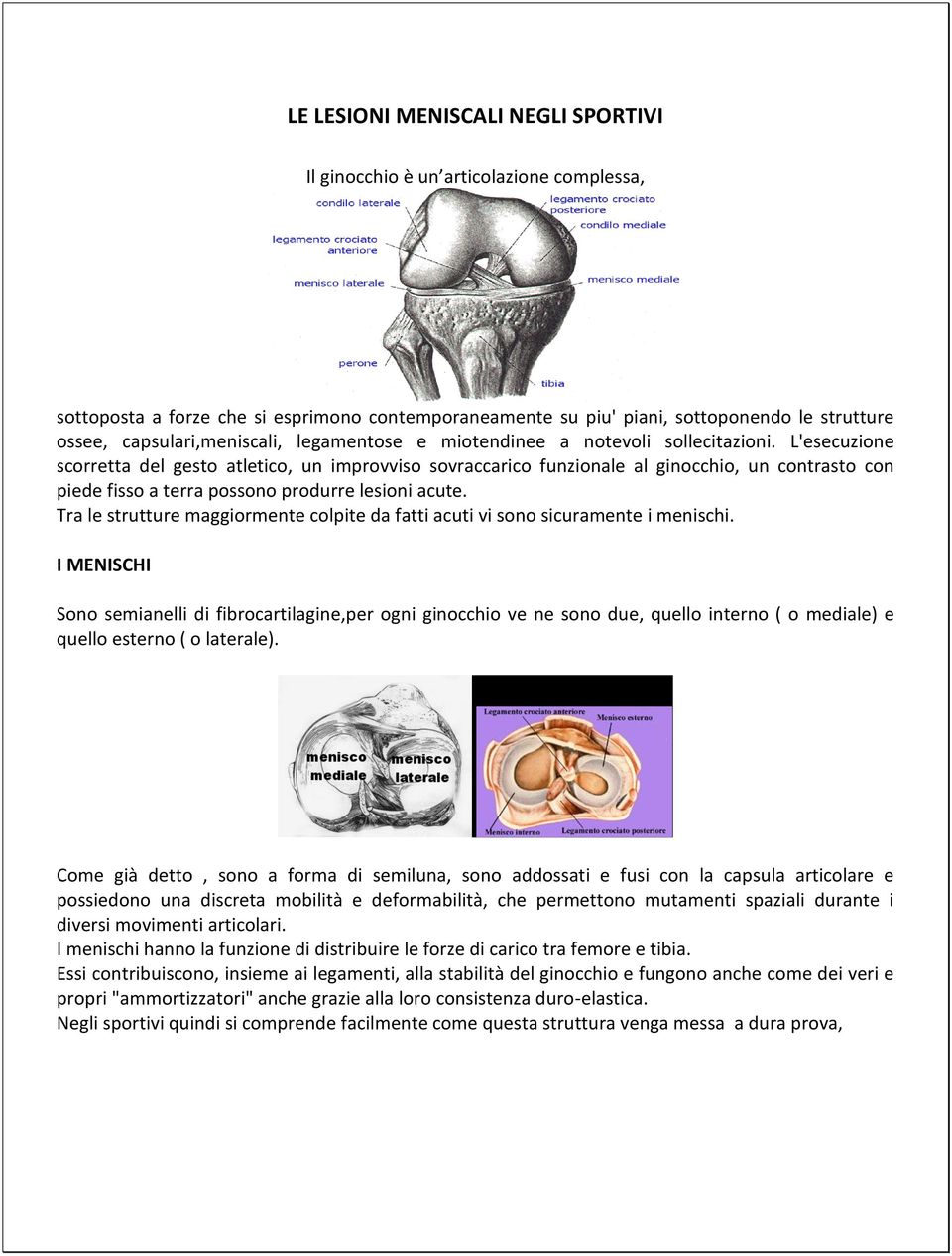 L'esecuzione scorretta del gesto atletico, un improvviso sovraccarico funzionale al ginocchio, un contrasto con piede fisso a terra possono produrre lesioni acute.