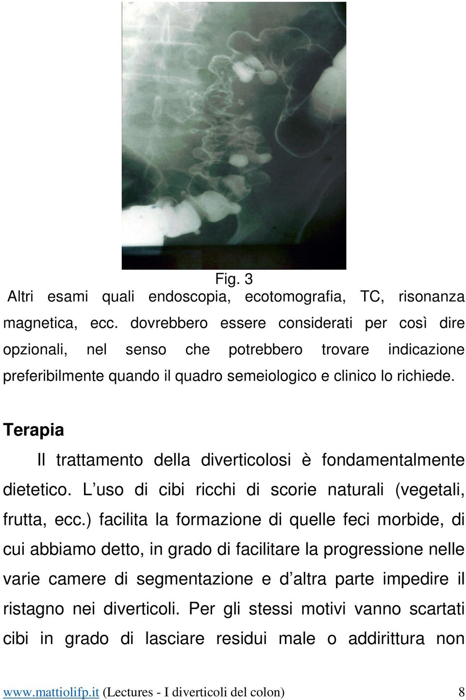 Terapia Il trattamento della diverticolosi è fondamentalmente dietetico. L uso di cibi ricchi di scorie naturali (vegetali, frutta, ecc.