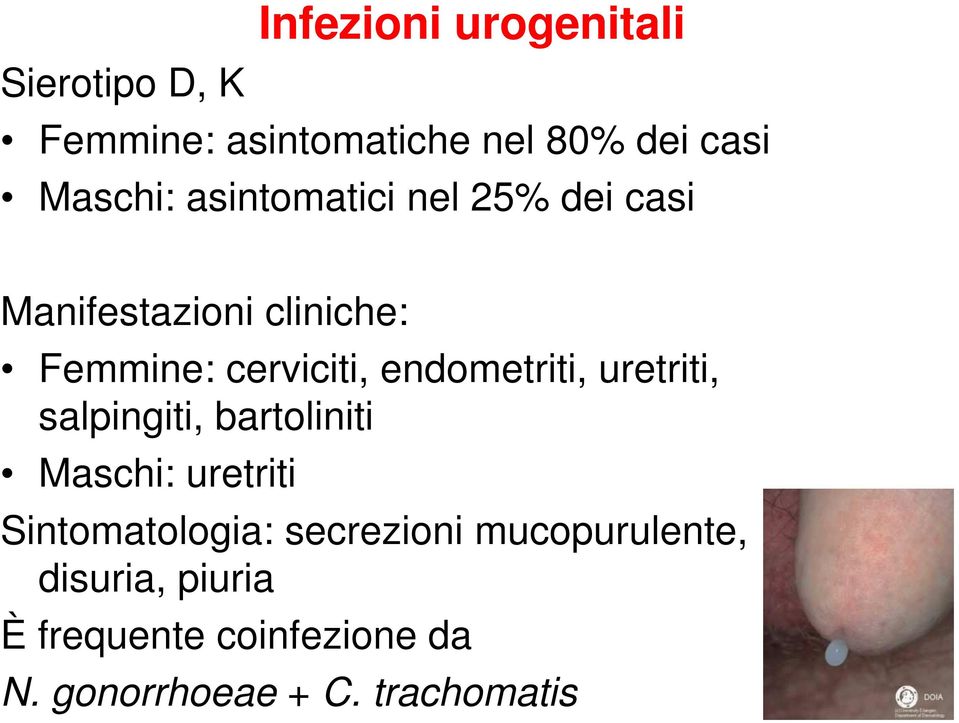 endometriti, uretriti, salpingiti, bartoliniti Maschi: uretriti Sintomatologia: