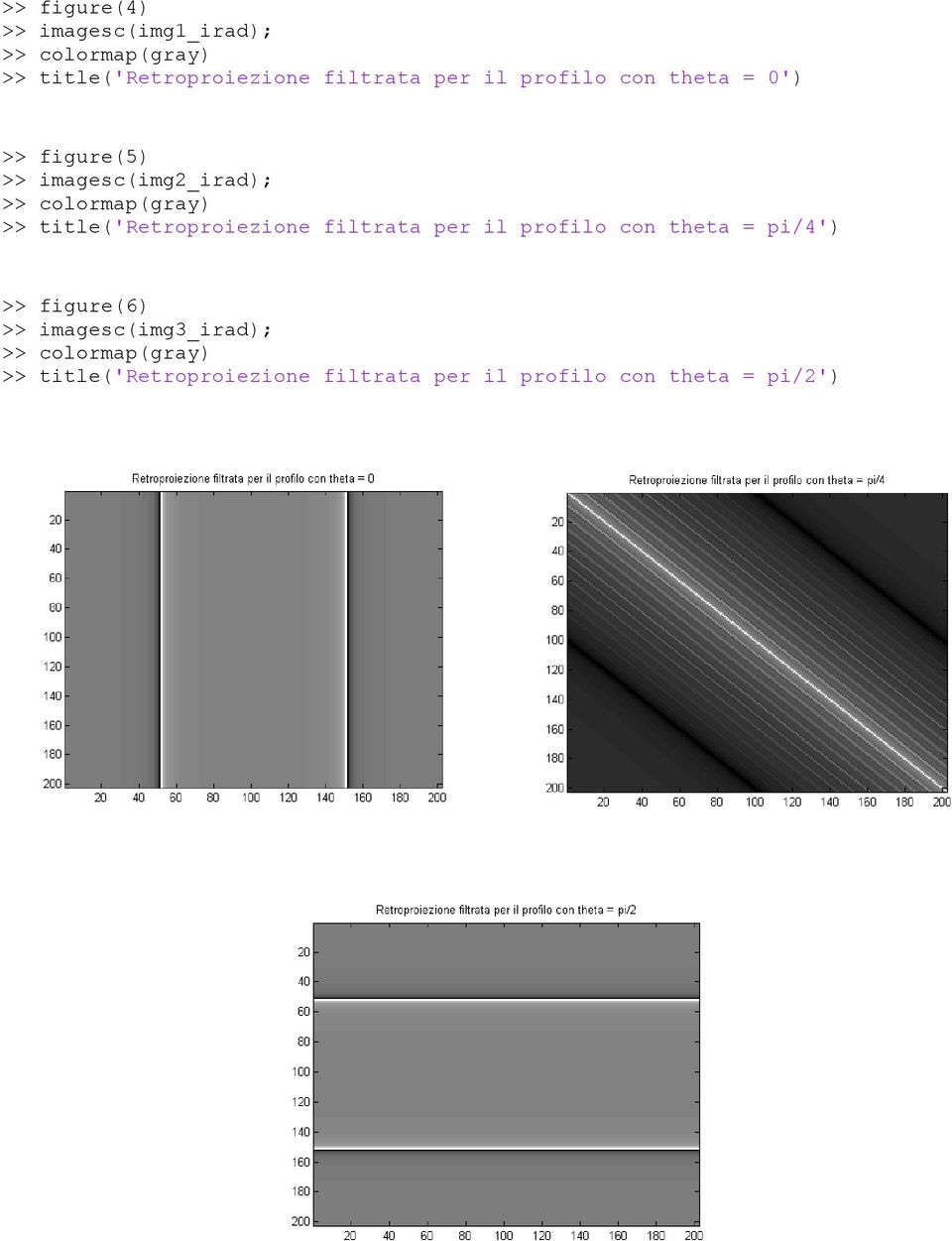 title('retroproiezione filtrata per il profilo con theta = pi/4') >>