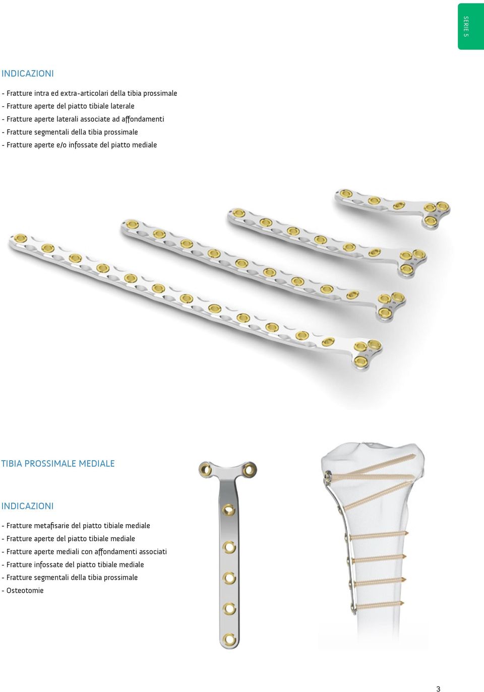 TIBIA PROSSIMALE MEDIALE INDICAZIONI - Fratture metafisarie del piatto tibiale mediale - Fratture aperte del piatto tibiale mediale -