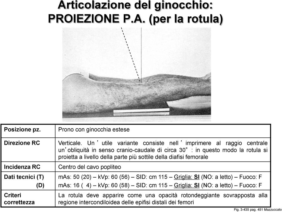 sottile della diafisi femorale Centro del cavo popliteo mas: 50 (20) kvp: 60 (56) SID: cm 115 Griglia: SI (NO: a letto) Fuoco: F mas: 16 ( 4) kvp: 60 (58) SID: cm 115 Griglia: SI