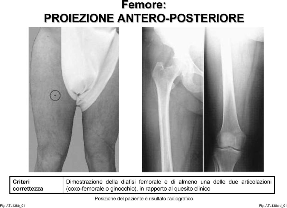 articolazioni (coxo-femorale o ginocchio), in rapporto al quesito