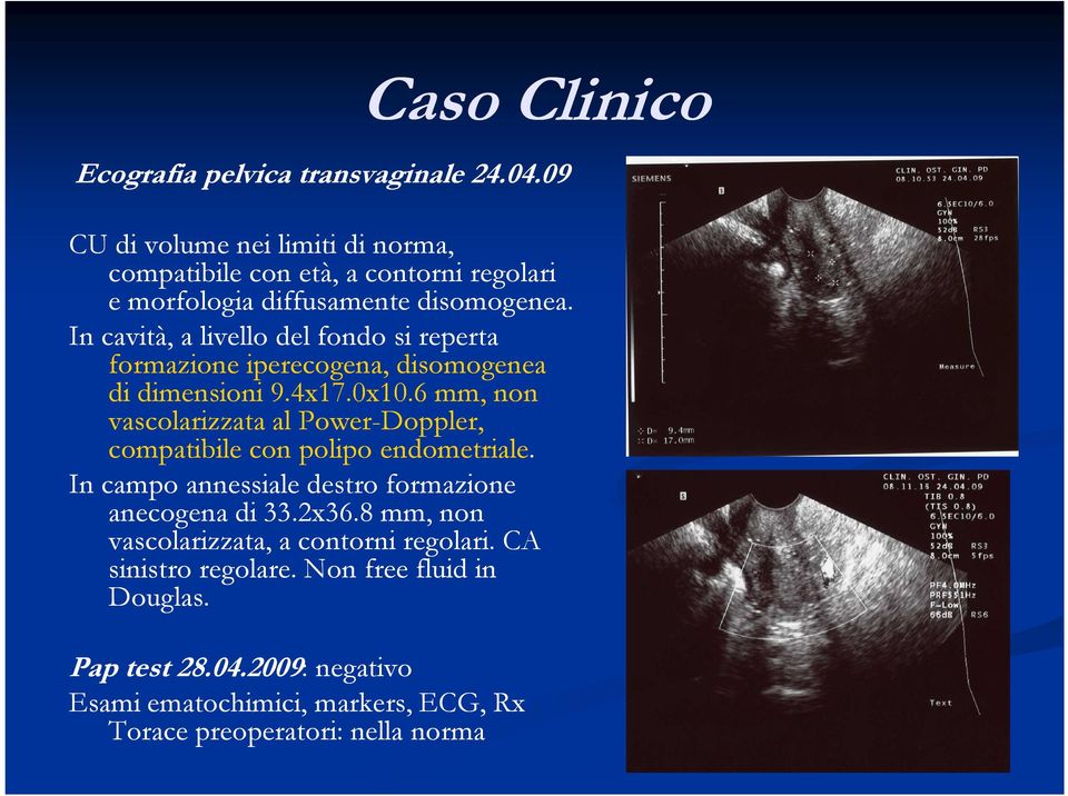 In cavità, a livello del fondo si reperta formazione iperecogena, disomogenea di dimensioni 9.4x17.0x10.