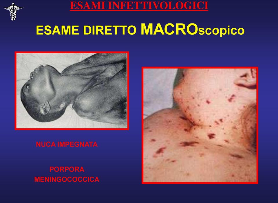 MACROscopico NUCA