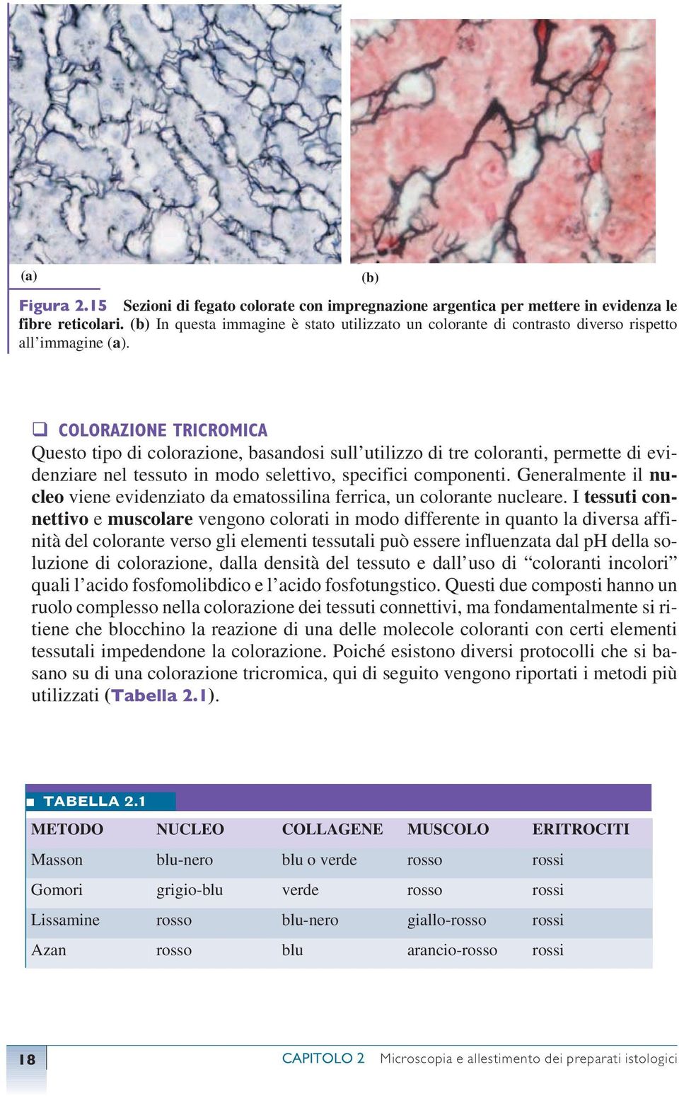 (b) COLORAZIONE TRICROMICA Questo tipo di colorazione, basandosi sull utilizzo di tre coloranti, permette di evidenziare nel tessuto in modo selettivo, specifici componenti.